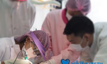 ถอนฟันคุด ผ่าตัดฟันคุด- Teeth Extraction, Wisdom teeth removal