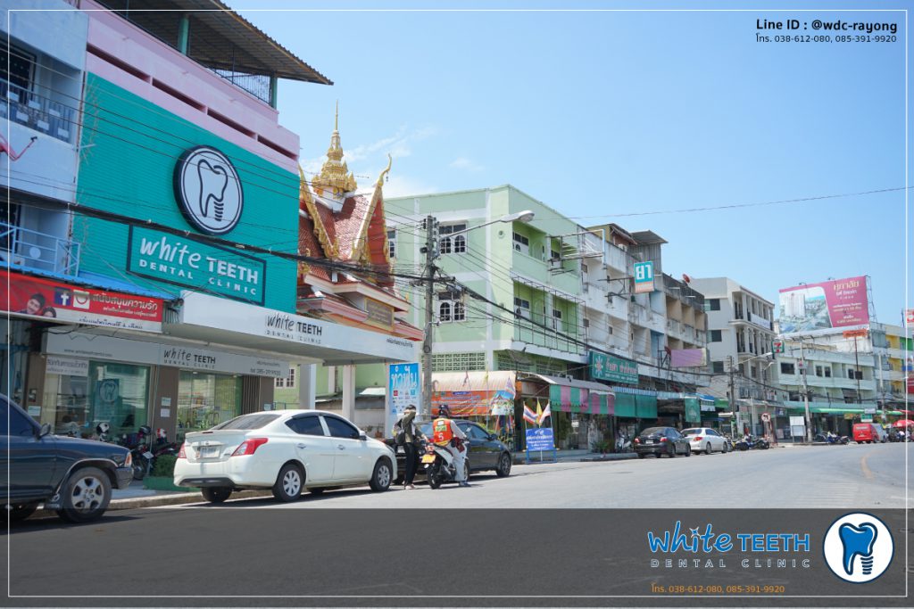 DSC05717-02 Contact Ampur Muang branch - White Teeth Dental Clinic Tel : 085-391-9920