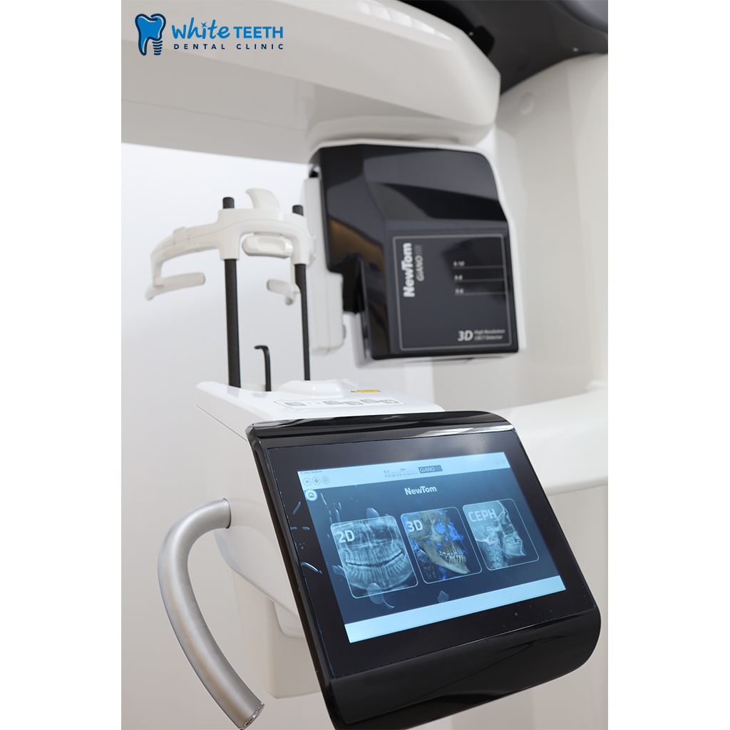 CBCT Scan 3D - คลินิกทันตกรรมไวท์ทีธ