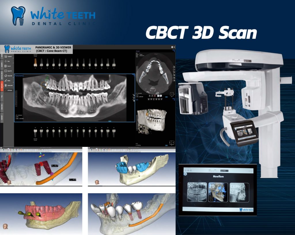 CBCT 3D Scan-White Teeth Dental Clinic