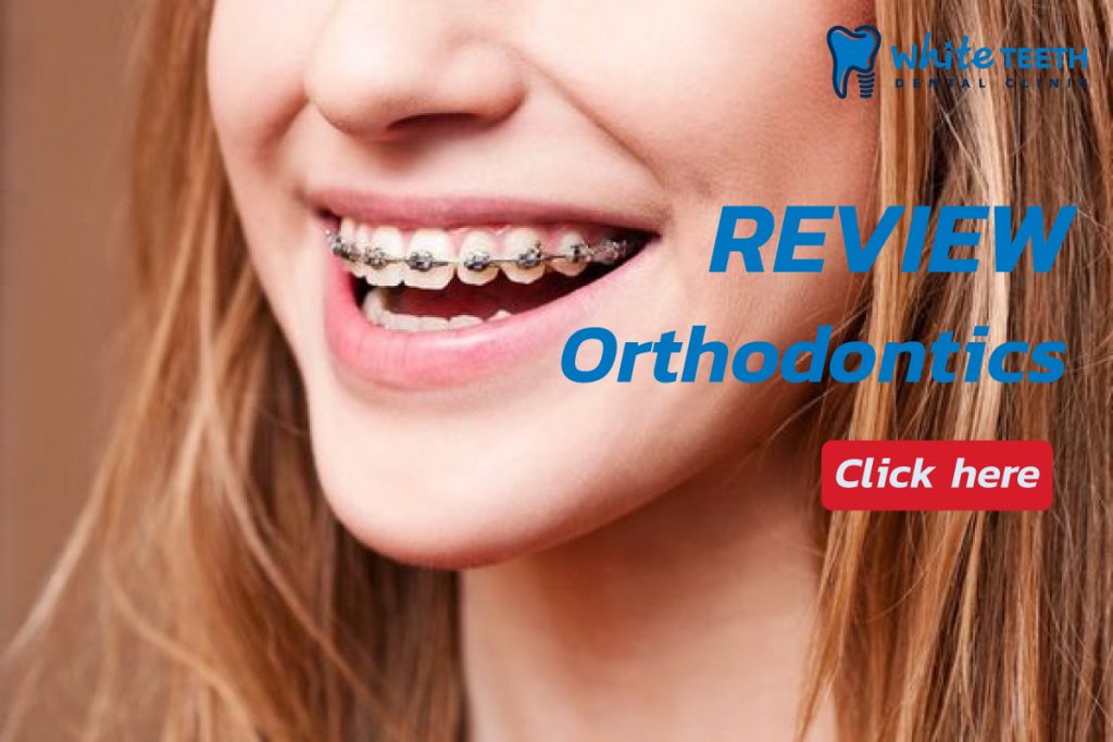 Orthodontic review - White Teeth Dental Clinic