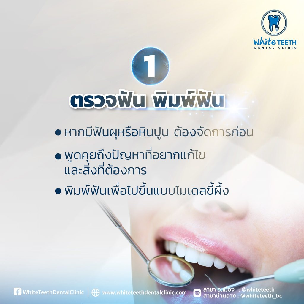 Veneer Procedure-ขั้นตอนการทำวีเนียร์_03 - คลินิกทันตกรรมไวท์ทีธ - White Teeth Dental Clinic