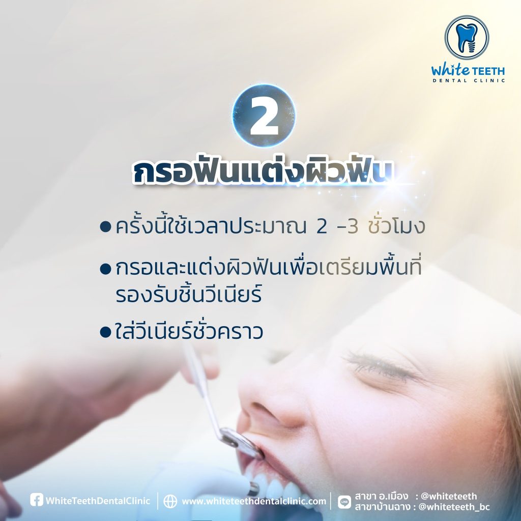 Veneer Procedure-ขั้นตอนการทำวีเนียร์_04 - คลินิกทันตกรรมไวท์ทีธ - White Teeth Dental Clinic