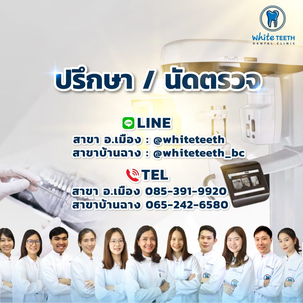 Veneer Procedure-ขั้นตอนการทำวีเนียร์_07 - คลินิกทันตกรรมไวท์ทีธ - White Teeth Dental Clinic