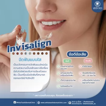 จัดฟันใส Invisalign คลินิกทันตกรรมไวท์ทีธ