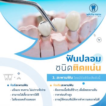 ฟันปลอม (Denture) - คลินิกทันตกรรมไวท์ทีธ (White Teeth Dental Clinic)